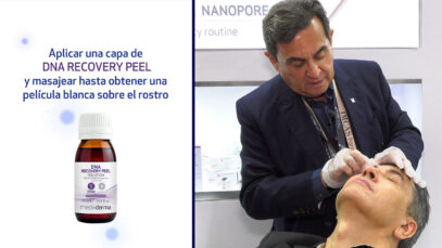 DNA-RECOVERY-PEEL-PLAY